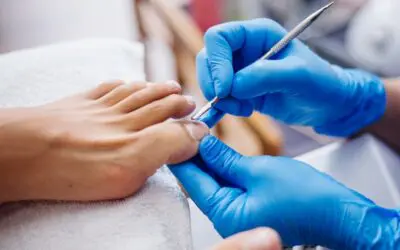The Risks of Ignoring Ingrown Toenails