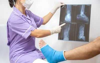 What Are The Risks of Ignoring a Foot Fracture?