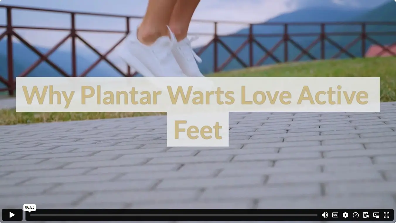 Why Plantar Warts Love Active Feet