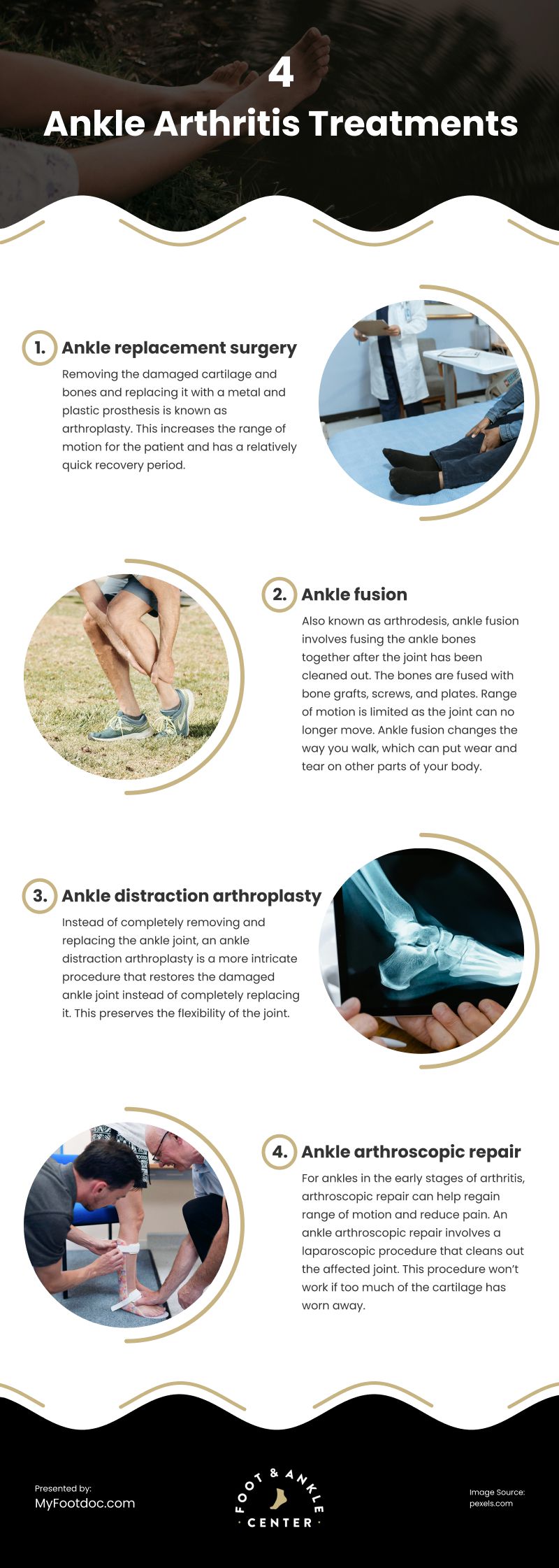 4 Ankle Arthritis Treatments Infographic