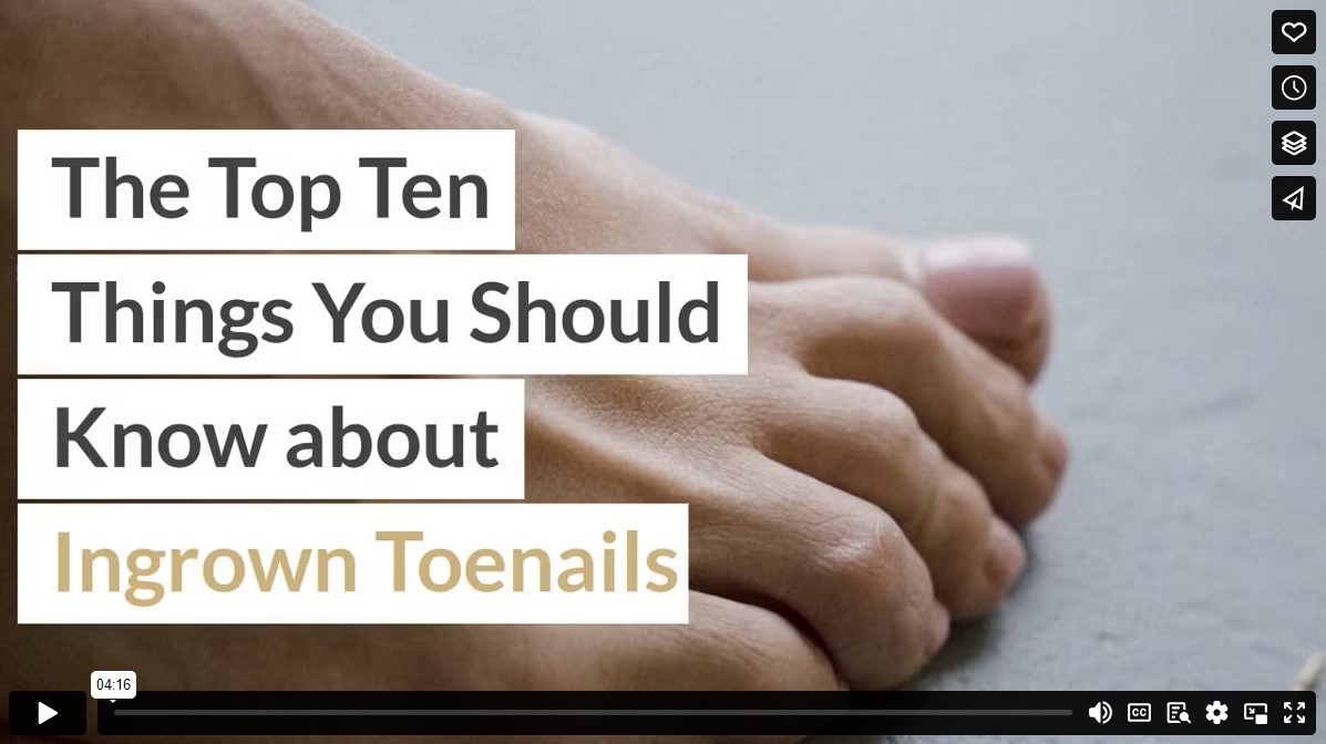 The Top Ten Things You Should Know about Ingrown Toenails