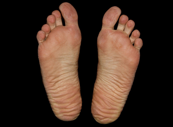 foot anatomy myfootdoc nv