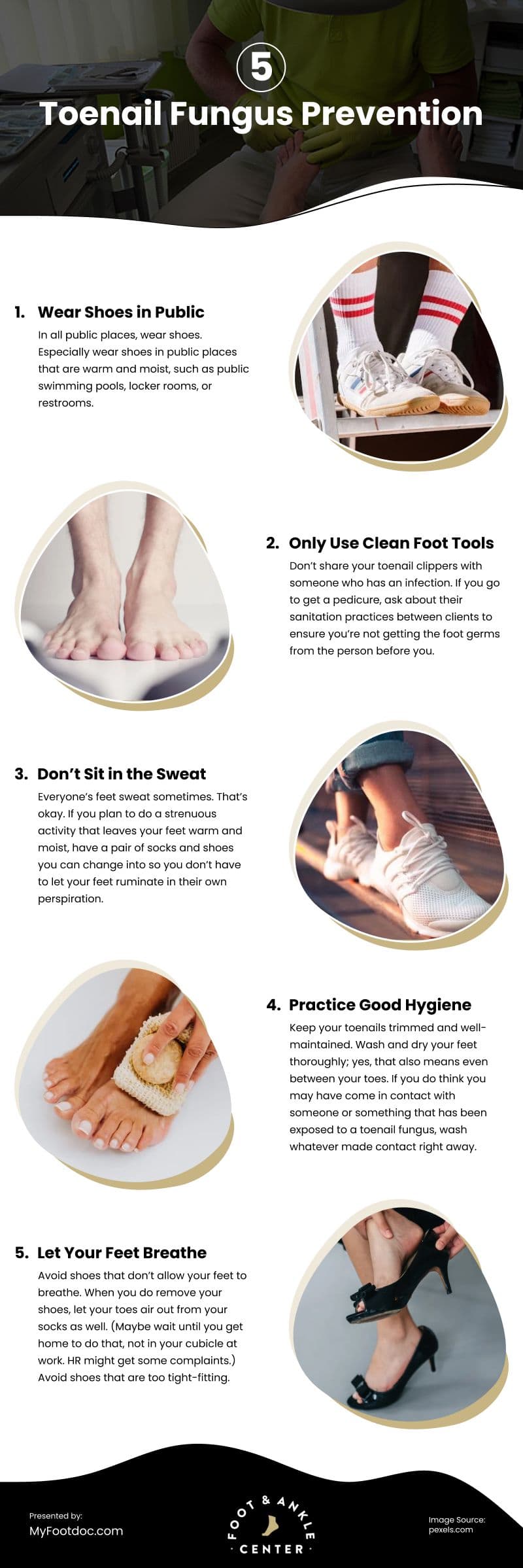 5 Toenail Fungus Prevention Infographic