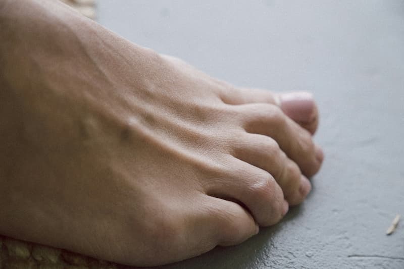 7 Essential Aftercare Tips for Ingrown Toenail Removal